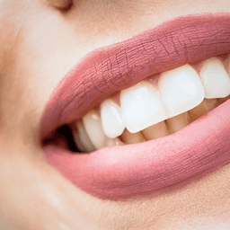 1 year supply of Dental Teeth whitening